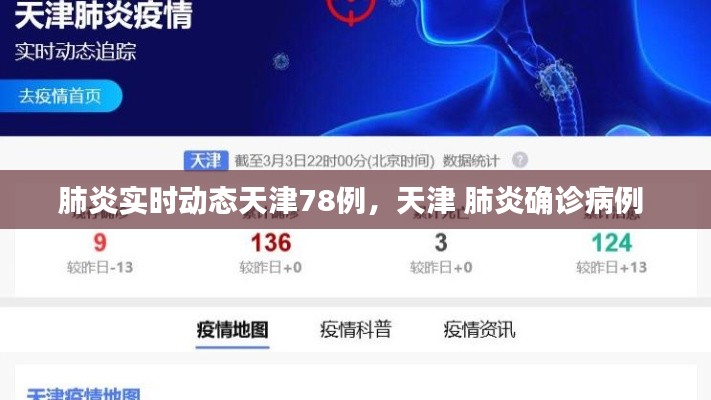 肺炎實(shí)時(shí)動(dòng)態(tài)天津78例，天津 肺炎確診病例 