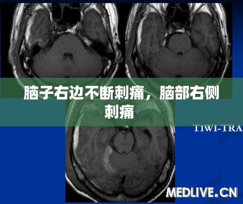 腦子右邊不斷刺痛，腦部右側(cè)刺痛 