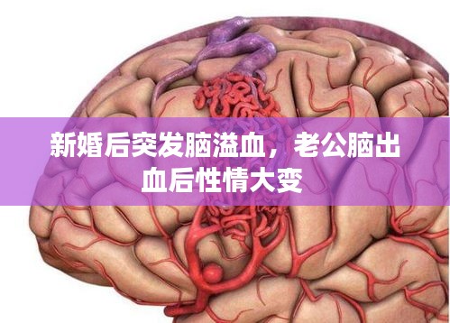 新婚后突發(fā)腦溢血，老公腦出血后性情大變 