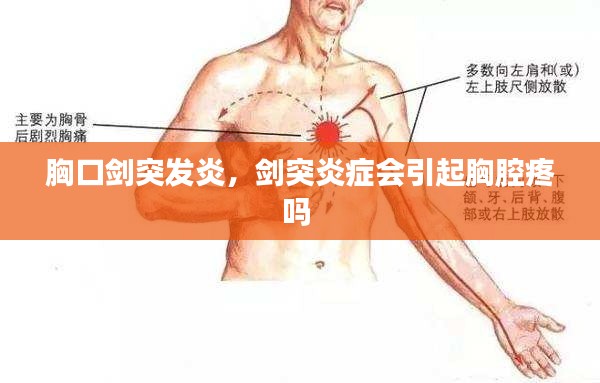 胸口劍突發(fā)炎，劍突炎癥會(huì)引起胸腔疼嗎 