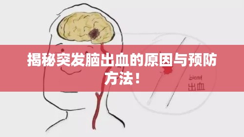 揭秘突發(fā)腦出血的原因與預(yù)防方法！