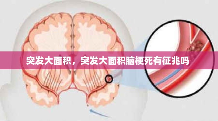 突發(fā)大面積，突發(fā)大面積腦梗死有征兆嗎 