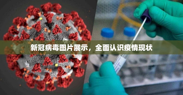 新冠病毒圖片展示，全面認(rèn)識疫情現(xiàn)狀