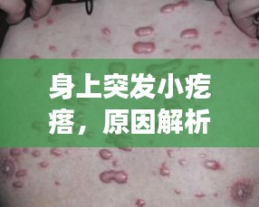 身上突發(fā)小疙瘩，原因解析、處理方法及預防策略