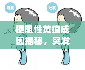 梗阻性黃疸成因揭秘，突發(fā)狀況如何應(yīng)對？應(yīng)對策略全解析