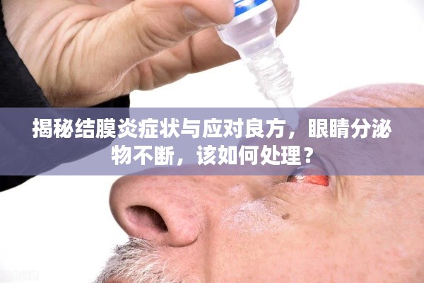 揭秘結(jié)膜炎癥狀與應(yīng)對良方，眼睛分泌物不斷，該如何處理？