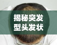 揭秘突發(fā)型頭發(fā)狀況，原因解析、應(yīng)對方法與日常護(hù)理全攻略