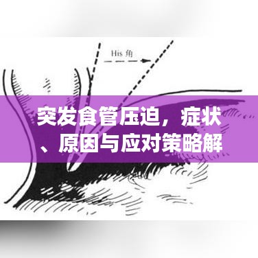 突發(fā)食管壓迫，癥狀、原因與應(yīng)對策略解析